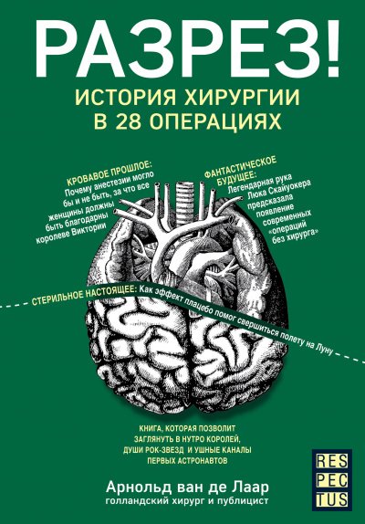 Разрез! История хирургии в 28 операциях - Арнольд Ван Де Лаар