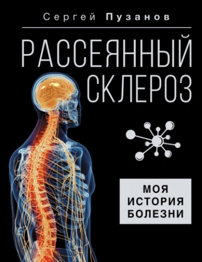 Аудиокнига Рассеянный склероз. Моя история болезни